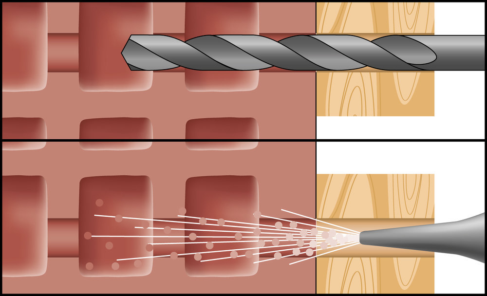 CELO Multifunktions- rahmendübel MFR SB 10-60 SSKS Produktbild img3 L