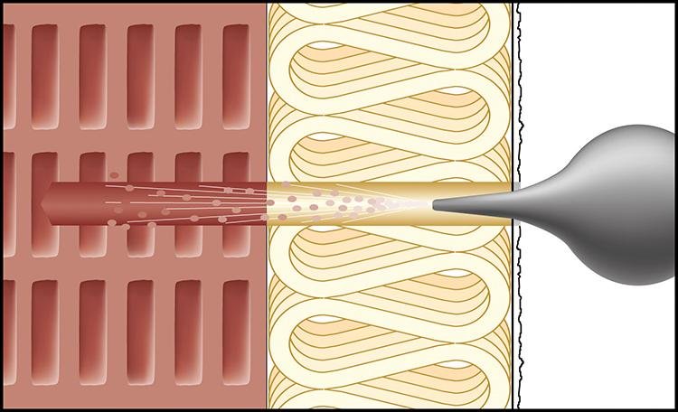 Abstandsmontagesystem ResiTHERM® Produktbild img63 L