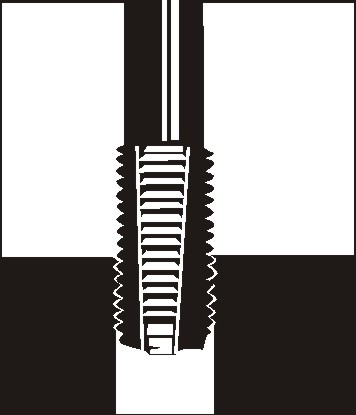 V-Coil Gewindereparatur-Einsätze Produktbild img4 L